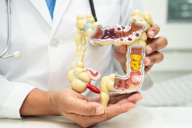 What are the early signs of colon cancer?