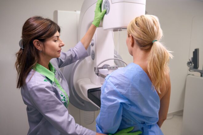 At what age should I start getting mammograms?