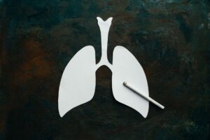 Best Ayurvedic Doctor Lung Cancer Treatment in Varanasi