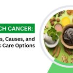 Stomach Cancer Symptoms