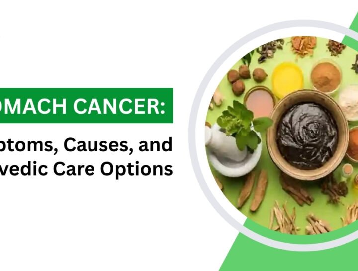 Stomach Cancer Symptoms